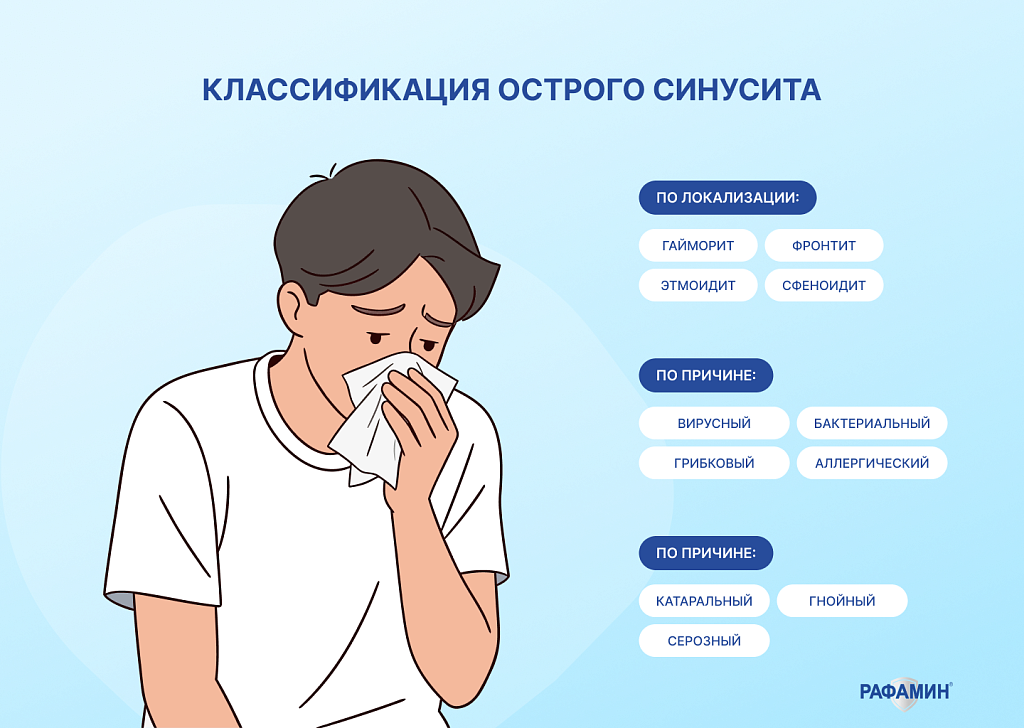 Классификация острого синусита